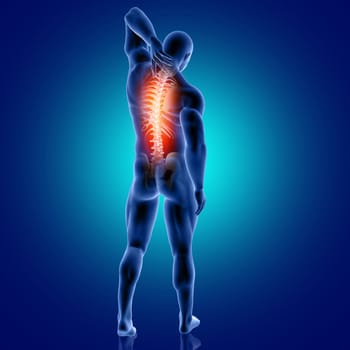 3D render of a male medical figure with spine highlighted
