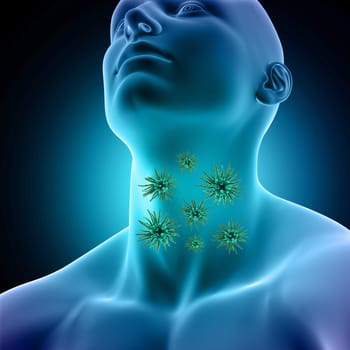 3D render of a male medical figure with virus cells on sore throat