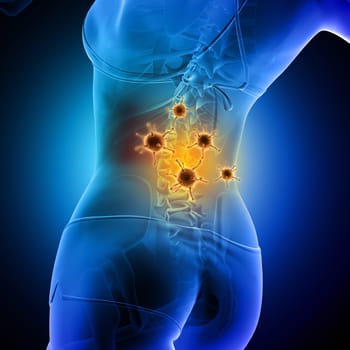 3D render of a medical background of a female figure with spine highlighted and virus cells