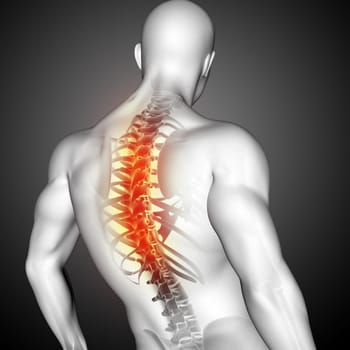 3D render of a male medical figure with spine highlighted
