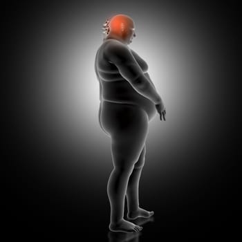 3D render of a medical background with overweight man holding head in pain