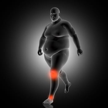 3D render of a medical background with overweight man with knee and ankles highlighted