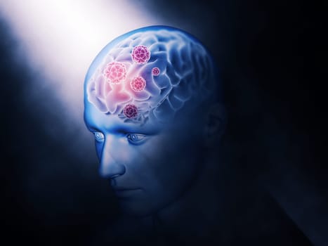 3D render of a medical background with virus cells on brain highlighted