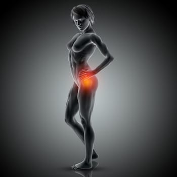 3D render of a medical image of female holding her hip in pain