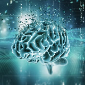 3D render of a medical image showing a brain shattering