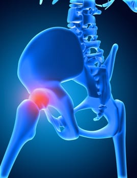 3D render of a medical image of skeleton with hip bone highlighted