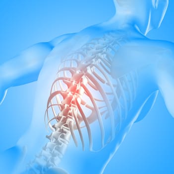3D render of a medical image of a male figure with spine highlighted