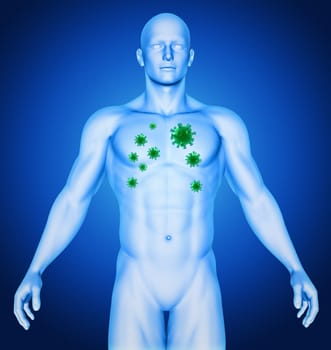 3D render of a medical image showing male with virus cells in his chest