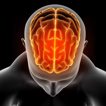 3D render of a medical image showing male figure with brain highlighted