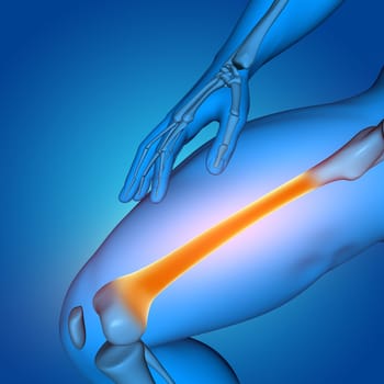 3D render of a medical male figure with close up of thigh bone