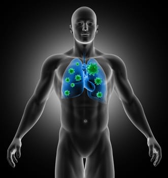 3D render of a medical image showing male with virus cells in his lungs