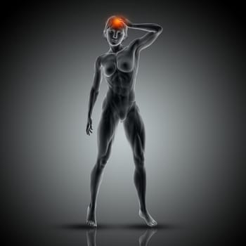 3D render of a medical image with female holding her head in pain