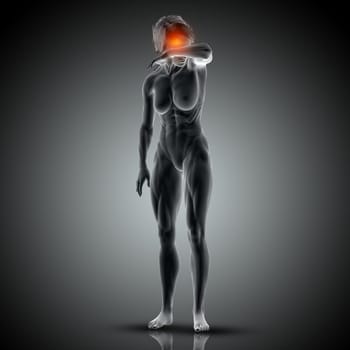 3D render of a medical image with female figure with head pain highlighted