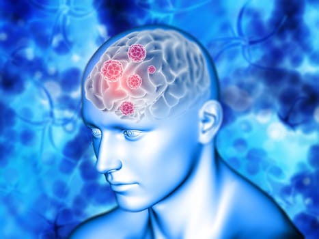 3D render of a medical background with virus cells on brain highlighted