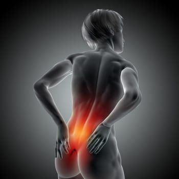 3D render of a medical image with female holding her back in pain