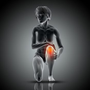 3D render of a medical image with female figure holding knee in pain