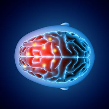 3D render of a medical image showing top view of a brain with parts highlighted