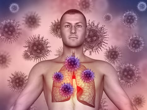 3D render of a medical image with male figure with virus cells attacking the lungs