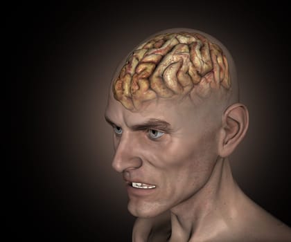 3D render of an old man with diseased brain
