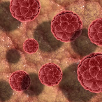 3D render of virus cells on a skin like texture