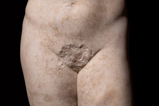 front view closeup detail of antique white marble human statue with genitalia missing on dark background metaphor for sexuality and gender