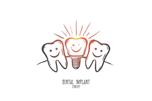 Dental implant concept. Hand drawn dental implant model. Implant tooth isolated vector illustration.