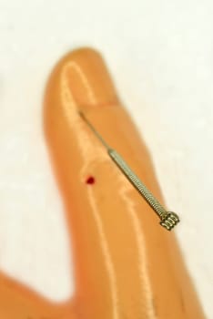 acupuncture demonstration on hand model