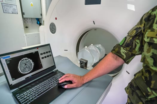 CT or computed tomography scanner inside army mobile field container ambulance, soldier showing patient with severe head trauma scan on laptop near.