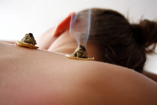 woman relaxes from acupuncture procedure. An acupuncturist doong acupuncture very accurately. Traditional chinese medicine