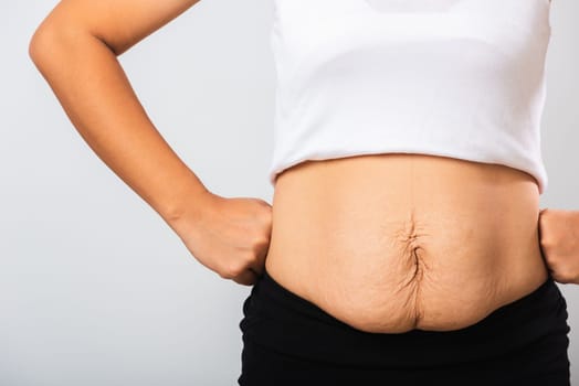 Close up of Asian mother woman showing stretch mark loose lower abdomen skin she fat after pregnancy baby birth, studio isolated on white background, Healthy belly overweight excess body concept