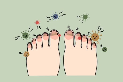 Person feet with nail disease or infection. Foot with onychomycosis or fungus on fingers. Medical treatment and procedure. Healthcare and medicine concept. Flat vector illustration.