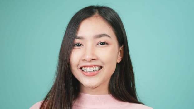 Portrait young Asian beautiful woman smiling wear silicone orthodontic retainers on teeth isolated on blue background, Teeth retaining tools after removable braces. Dental hygiene and health concept