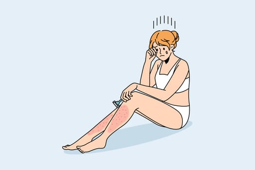 Skin problems after shaving concept. Young crying female sitting with red sore legs having problems with shaving vector illustration