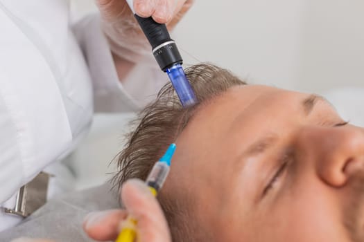Alopecia. Man hair loss improve growth treatment regeneration, dermapen microneedling vitamin exosomes syringe injections. Trichologist cosmetologist doctor head scalp procedure fractional mesotherapy