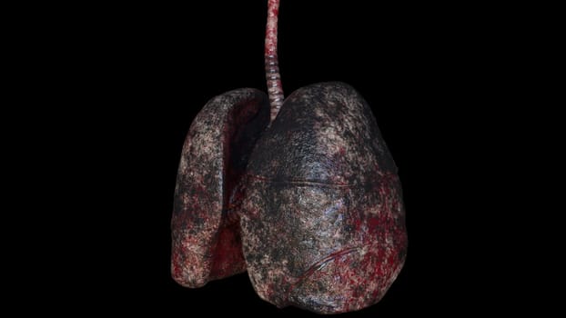 Respiratory organs darkened from resins with 3d render unhealthy spots. Anatomical trachea affected by cancer with diseased pleura leaking viruses. Bad habit symbol with realistic design.