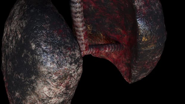 Respiratory organs darkened from resins with 3d render unhealthy spots. Anatomical trachea affected by cancer with diseased pleura leaking viruses. Bad habit symbol with realistic design.