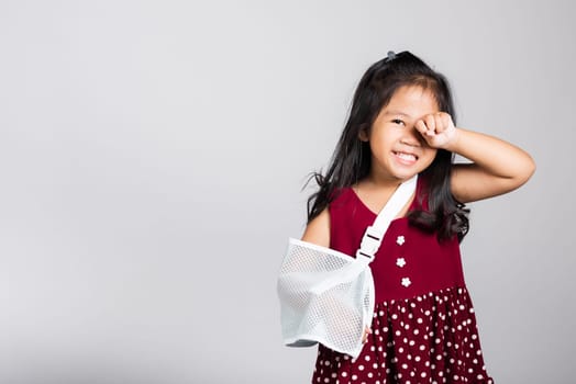 Arm broken. Little cute kid girl 3-4 years old hand bone broken from accident with arm splint in studio shot isolated on white background, Asian children preschool injured after accident, health concept