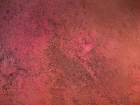 Man with a severe burn on his back. Close up.