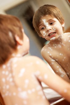 Chickenpox IV.
