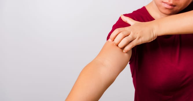 Asian beautiful woman itching her scratching her itchy arm on white background with copy space, Medical and Healthcare concept