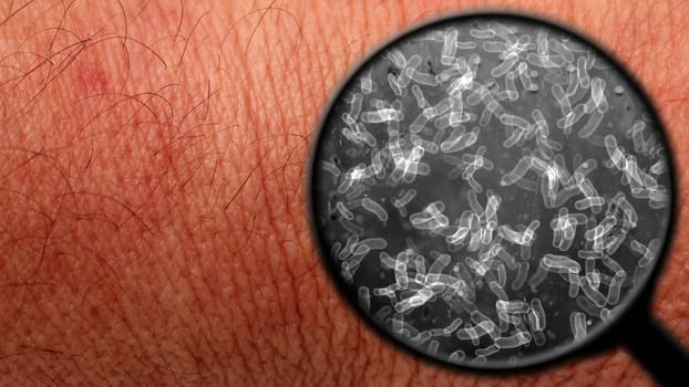 Searching for bacteria on human skin,Searching for bacteria on human skin