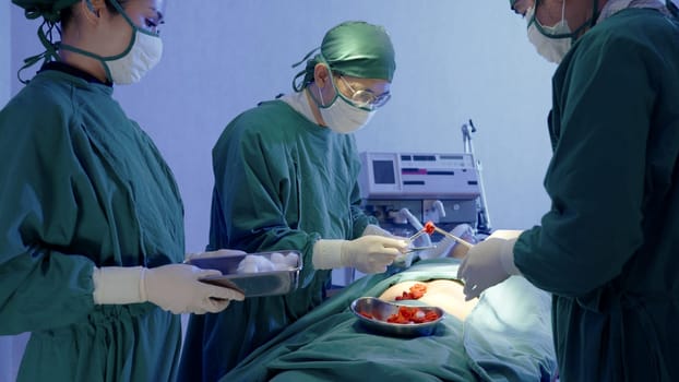 Medical surgical doctor team performing surgery patient, Group surgeon at work on operating room with electrocautery equipment for cardiovascular emergency surgery center in hospital