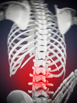 3D illustration showing back pain. 3D illustration.