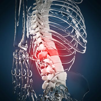 3D illustration showing back pain. 3D illustration.