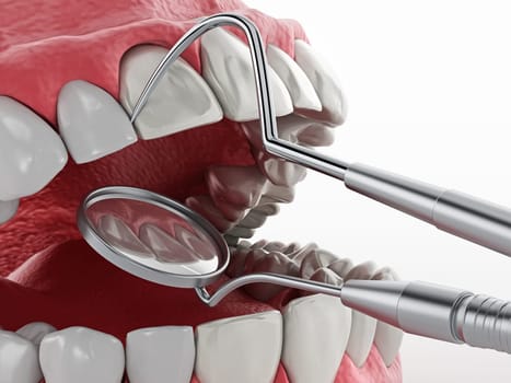 Professional dentist tools isolated on white background. 3D illustration.