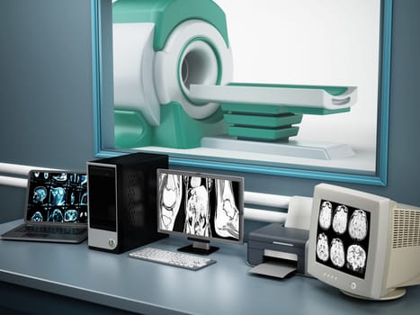 Magnetic Resonance Imaging MRI device and computer systems.