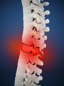 3D illustration showing back pain. 3D illustration.