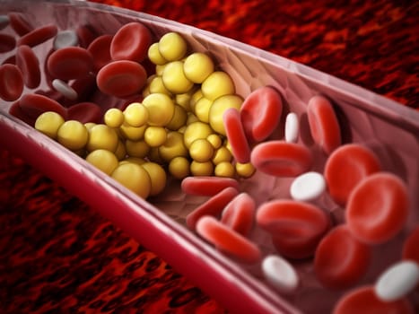 Fat cells blocking the blood flow inside human vein. 3D illustration.