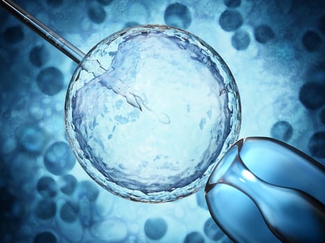 3D illustration of artificial insemination process showings sperms being injected inside the ovule. 3D illustration.