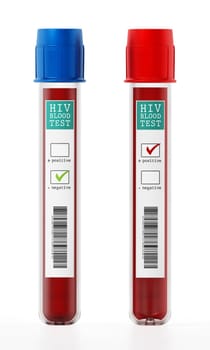 Positive and negative blood samples in vials with HIV test labels. 3D illustration.